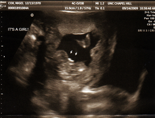 It’s a girl